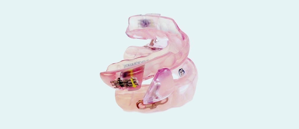 SomnoDent® Fusion dental appliance